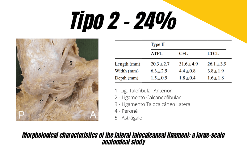 2.  Ligamento talocalcaneo lateral Ecografia tempo formacion.png